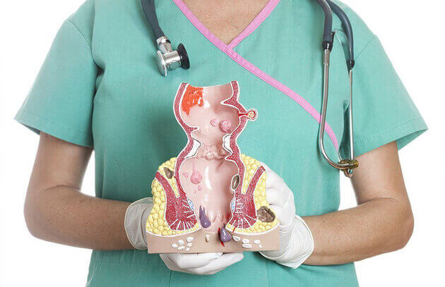 Ozonoterapia  por via de aplicacion rectal